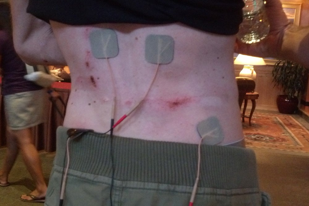 My teammate Jeremy Vennell crashed on his back during the second stage. Race medical provided this muscle stimulator gizmo to speed recovery. Photo: Phil Gaimon | VeloNews.com