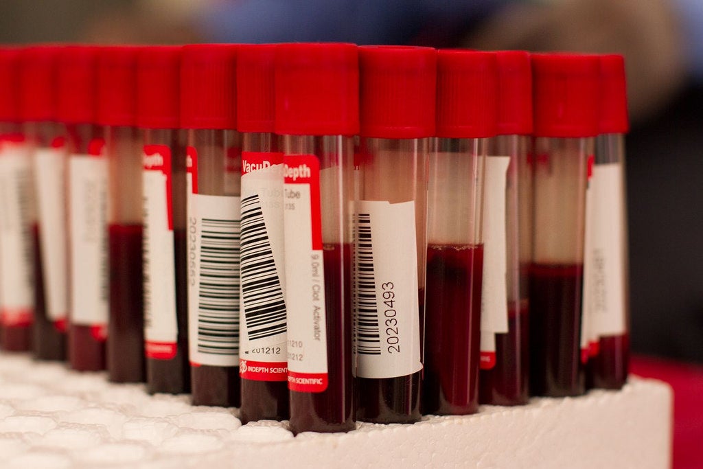 Could WADA know the secrets behind Operacion Puerto's mysterious blood bags?